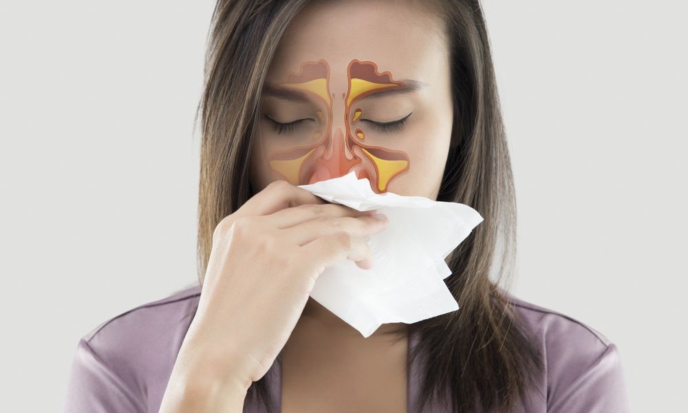 Điều trị hắt hơi liên tục bằng thuốc
